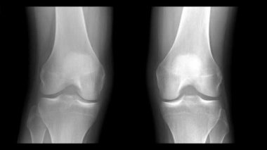Vücut parçalarının tomografisini veya röntgen taramasını durdur. İnsan eli, bilek, bacak, ayak bileği, diz, ayak, ayak parmakları, avuç içi, eklemler, kemikler. Cadılar Bayramı geçmişi.
