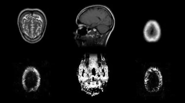 MRI beyin taraması zaman aşımı, insan kafasının manyetik rezonans görüntüsü. BT taramasının hareketli görüntüsünü anatomik detaylarla durdur. İnsan kafasının kusursuz döngü animasyonu.