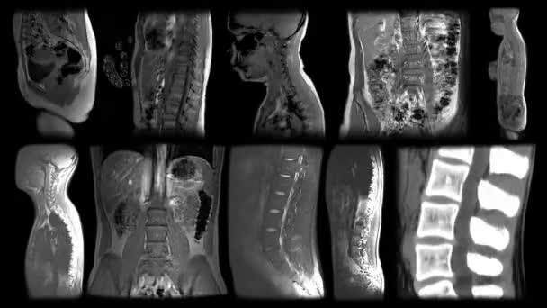 MRI scan timelapse de vários lados corpo humano, coluna vertebral, órgãos ósseos, ressonância magnética do esqueleto, CT, raio-x, vista lateral, animação stop motion. loop sem costura . — Vídeo de Stock