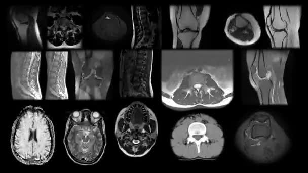 МРТ-сканирование хронологии различных сторон человеческого тела, позвоночника, костных органов, магнитно-резонансная томография скелета, КТ, рентгена, бокового вида, анимация стоп-движения. Бесшовный цикл. — стоковое видео