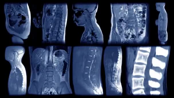 МРТ-сканування встановлюють багатоекранний, людський мозок, голову, тіло, кістки, хребет і органи. Анімована мозаїка зупинки руху різних частин тіла КТ сканування або рентгенівського променя. Пульсаційна анатомія безшовна петля . — стокове відео