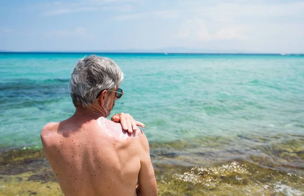 Uomo Anziano Che Utilizza Crema Solare Durante Vacanze Estive — Foto Stock