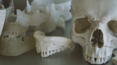 İnsan kafatası. İnsan kafatası yerleşimini tablodur