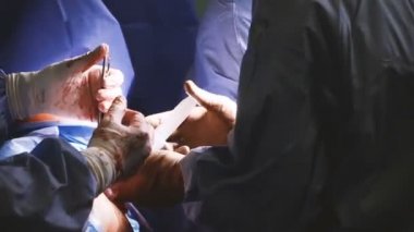 İşlem. Kalça protezi ameliyatı. Cerrahın elleri.