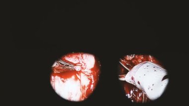 Ameliyat. Robot operasyon. Ameliyat. Robot operasyon.