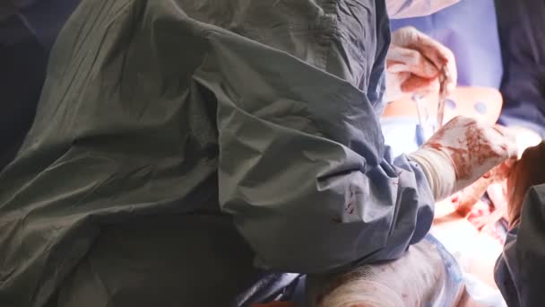 Opération Chirurgie Hanche Les Mains Chirurgien — Video