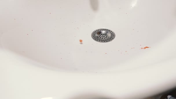 洗面器の中の血で引き裂かれた歯 — ストック動画