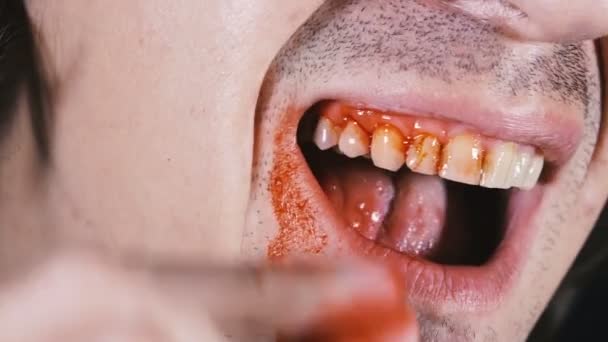 Zahn Mann Zieht Sich Einen Gefallenen Zahn Aus Dem Mund — Stockvideo