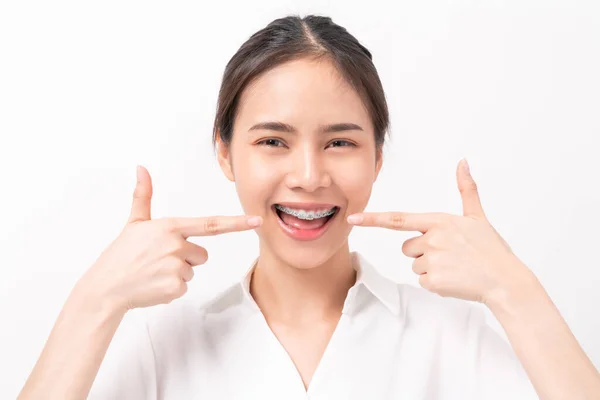 Rosto Uma Jovem Mulher Asiática Sorridente Com Aparelho Nos Dentes — Fotografia de Stock