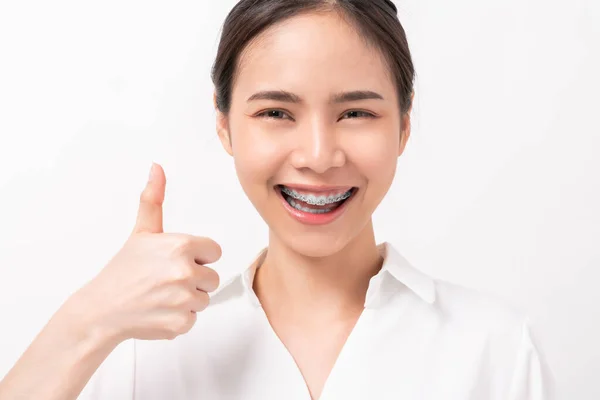 Посміхаючись Азіатською Жінкою Показуючи Пальцями Вгору Або Обличчя Брекетів Зубах — стокове фото