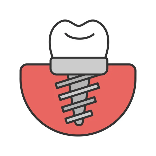 Ícone Cor Implante Dentário Implante Endosseado Ilustração Vetorial Isolada —  Vetores de Stock