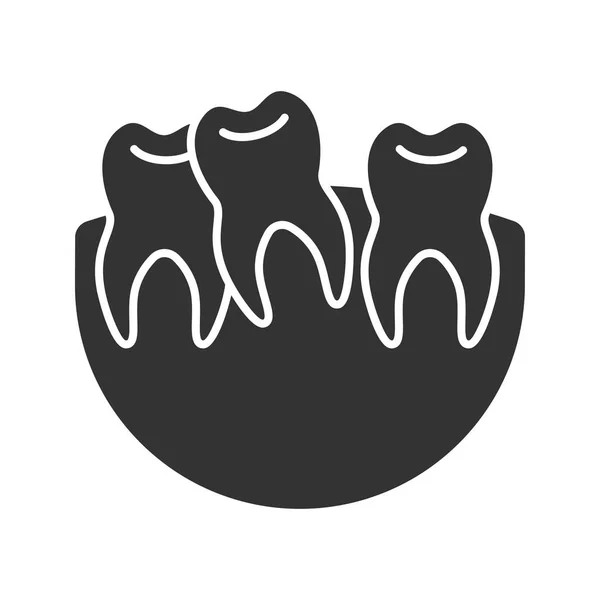 Crooked Teeth Glyph Icon Malocclusion Wisdom Tooth Problem Silhouette Symbol — Stock Vector