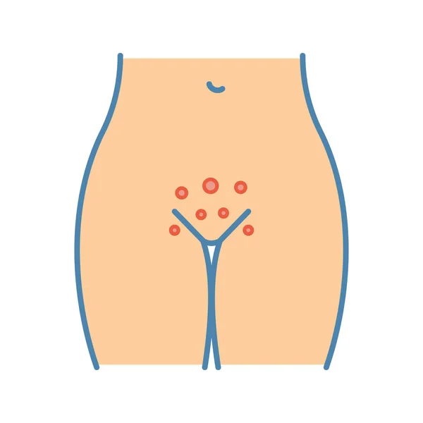 Gynaecologische Besmettelijke Vaginale Huiduitslag Kleur Pictogram — Stockvector