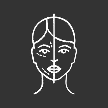 Önce ve sonra simge nörotoksin enjeksiyon tebeşir. Kozmetik prosedür. Yüz gençleştirme. Estetik Tıp. Kozmetik. İzole vektör kara tahta çizim