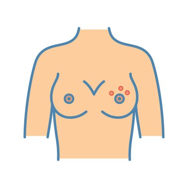 Meme döküntü renk simgesi. Cilt tahriş veya dimpling. Meme ucu dermatit, apse, Kuru cilt. Meme kanseri belirti. İzole vektör çizim