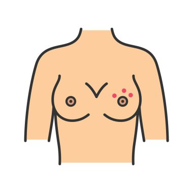 Meme döküntü renk simgesi. Cilt tahriş veya dimpling. Meme ucu dermatit, apse, Kuru cilt. Meme kanseri belirti. İzole vektör çizim