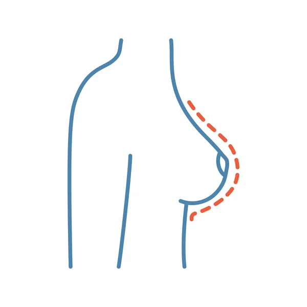 Значок Кольору Збільшення Грудей Корекційна Операція Грудях Жінки Мамопластика Пластична — стоковий вектор