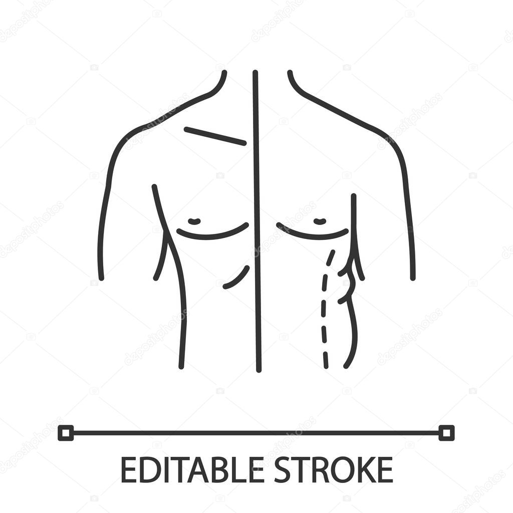 Male coolsculpting linear icon. Flanks correction. Male liposuction and body contouring before and after. Plastic surgery. Contour symbol. Vector isolated outline drawing. Editable stroke