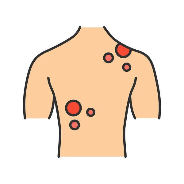 Icona Del Colore Del Cancro Della Pelle Malattie Dermatologiche Eruzione — Vettoriale Stock