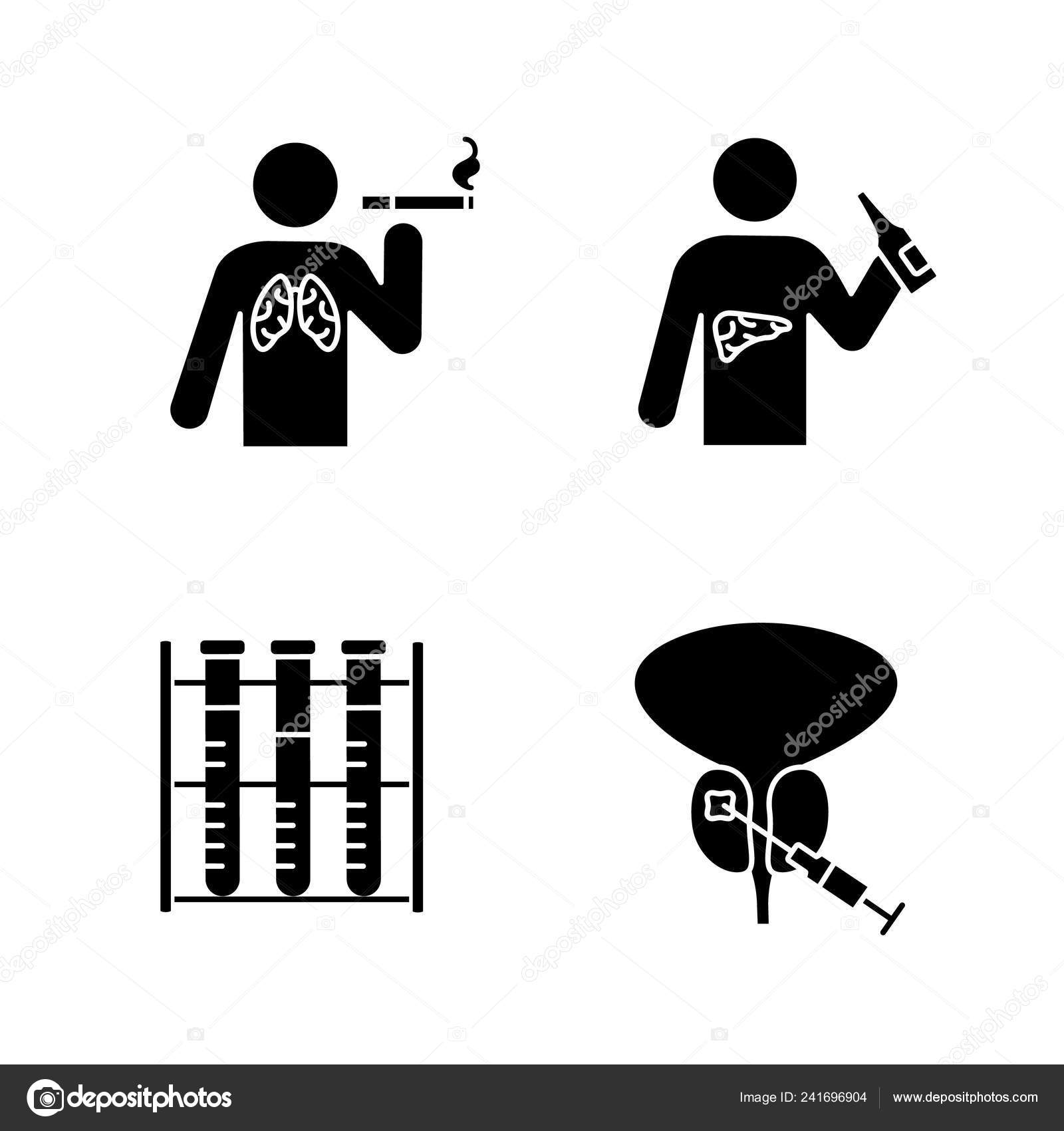 prostate alcoholism