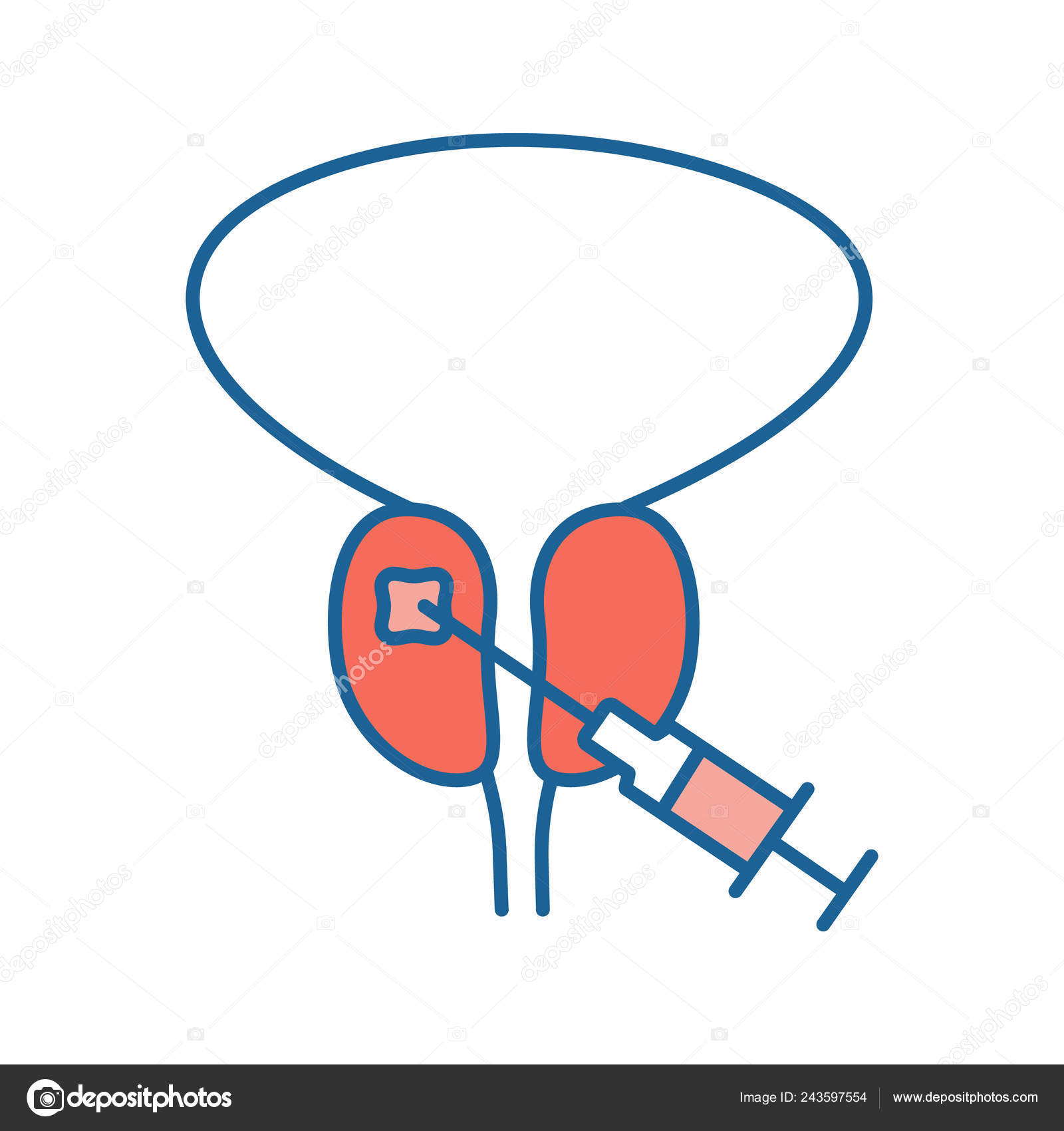 biopsia prostata pdf gratis