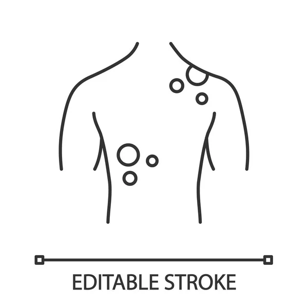 Huden Cancer Linjär Ikonen Tunn Linje Illustration Dermatologiska Sjukdomar Hudutslag — Stock vektor