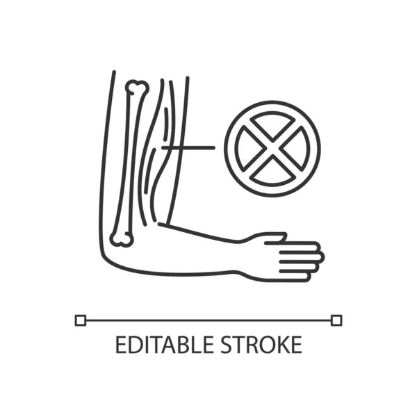 肌营养不良线形图标 慢性遗传病 人体手臂组织损伤 细线可定制的示例 绕道标志 矢量孤立的轮廓图 可编辑笔划 — 图库矢量图片