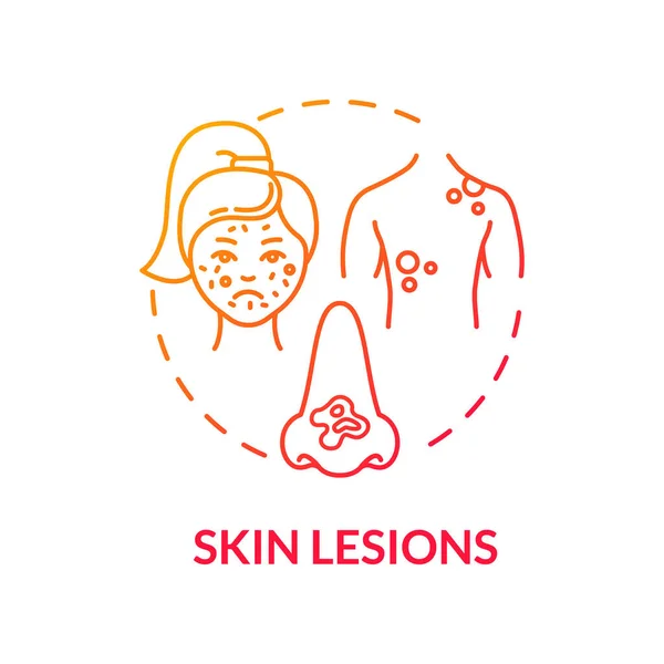 Skin Lesions Concept Icon Dermatology Skin Moles Growths Self Examination — Stock Vector
