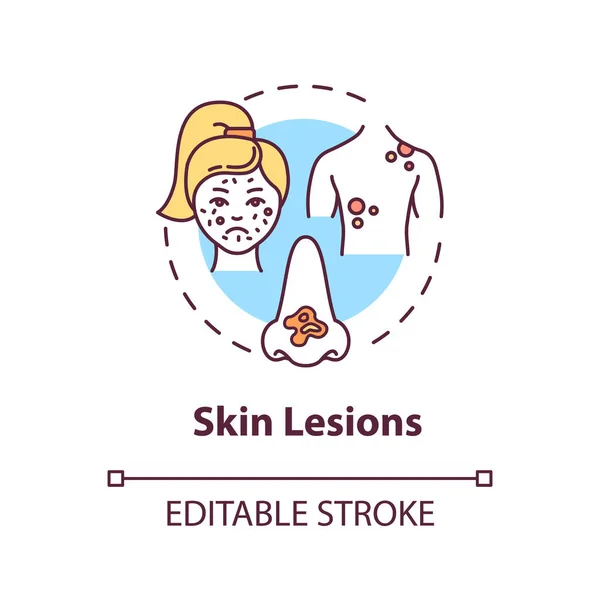 Ikona Pojetí Kožních Lézí Dermatologie Kožní Skvrny Rány Abnormální Barevné — Stockový vektor