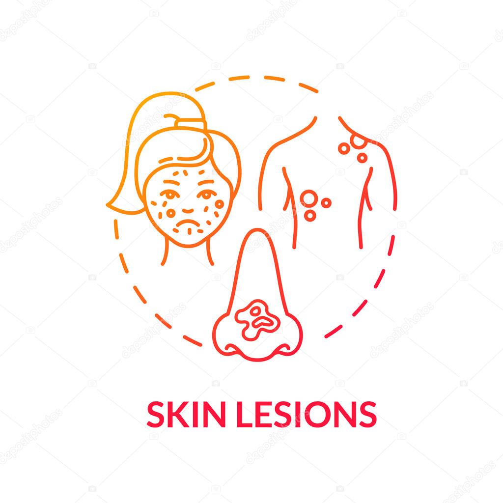 Skin lesions concept icon. Dermatology. Skin moles and growths. Self examination. Abnormal colored epidermis idea thin line illustration. Vector isolated outline RGB color drawing