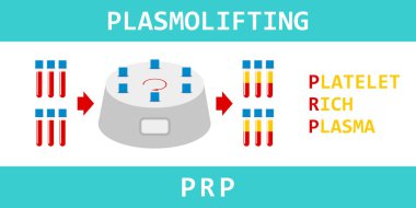 Trombosit zengin plazma. Plasmolifting, tedavi Prp. tüp kan ve santrifüj ile modern yöntem. Vektör çizim. 