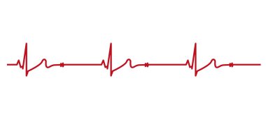 EKG kalp atışı hattı. Elektrokardiyogram vektör çizimi. Sinüs bradikardisi. Vektör