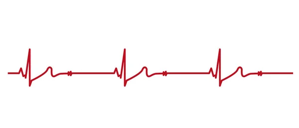 Ecg Heartbeat Line Ilustração Vetorial Eletrocardiograma Bradicardia Sinusal Vetor — Vetor de Stock