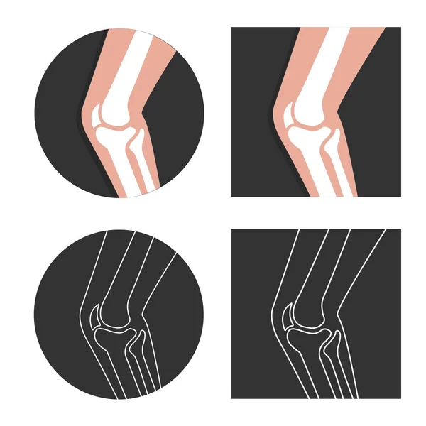 Vector Menselijke Knie Gezamenlijke Pictogram Plat — Stockvector