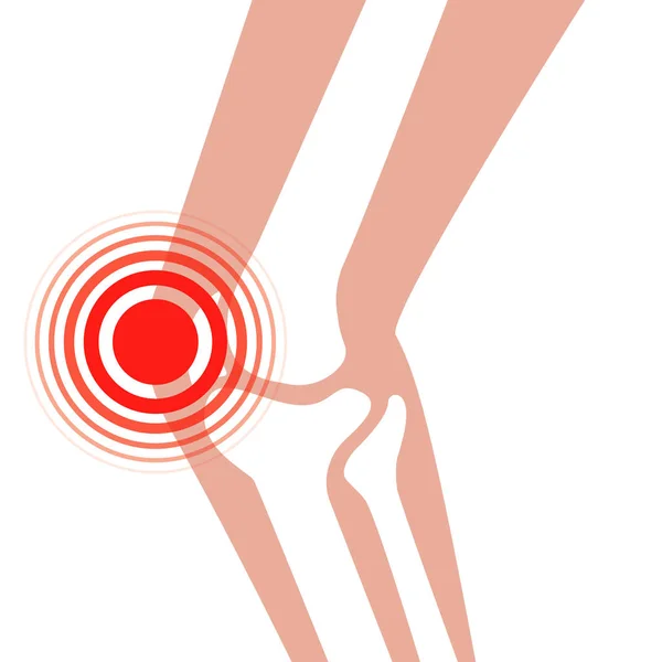Ortopedyczne medyczne ikony bólu kolana — Wektor stockowy