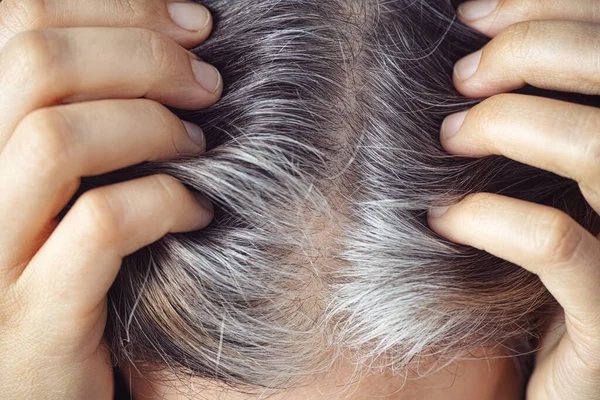 Uma Mulher Mostrando Suas Raízes Cabelo Grisalho Concepção Cinzenta Fechar — Fotografia de Stock