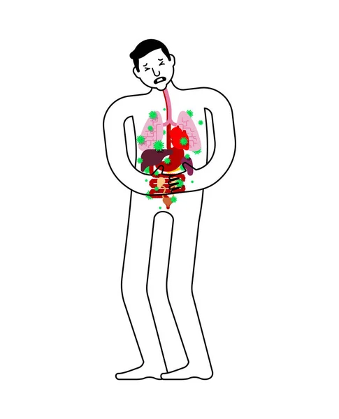 生病的内脏器官人类疾病的解剖 心和肺 肝脏和胃 食道和胰腺 肾和脾脏令人关注的病毒和细菌 生病的人 — 图库矢量图片