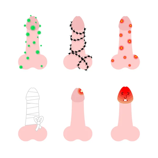 Бірінші ауызша секс Өкшедегі кончар фото