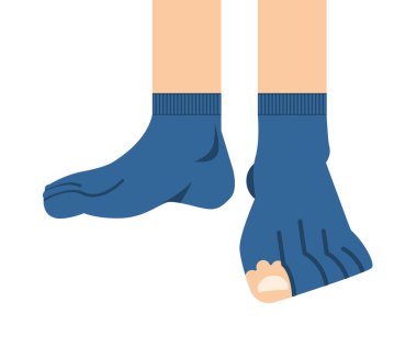 Yırtık çorap. Sızdıran çorap. Ayak parmağında delik ve parmak görünür.