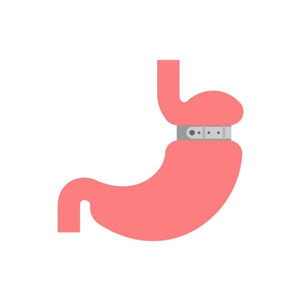 Stomach banding isolated. Adjustable Gastric Band. vector illustration