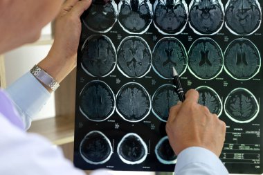 Profesyonel beyin doktoru hastaya danışmanlık yapar ve sağlık için gerekli detayları verir. Stetoskop tıbbi gereçler masada.