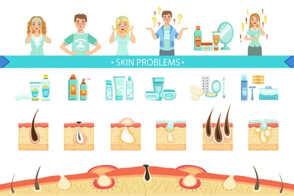 Problemas de pele Cartaz médico infográfico. Desenhos animados Estilo Saúde Acne Issue Info Ilustração . —  Vetores de Stock
