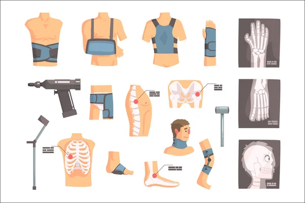 Cirugía ortopédica y ortopedia atributos y herramientas conjunto de iconos de dibujos animados con vendajes, rayos X y otros objetos médicos . — Archivo Imágenes Vectoriales