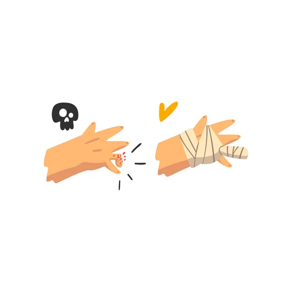 Fractuur van de vinger, hand gepleisterd, lichamelijk letsel, eerste hulp en behandeling vector illustratie op een witte achtergrond — Stockvector