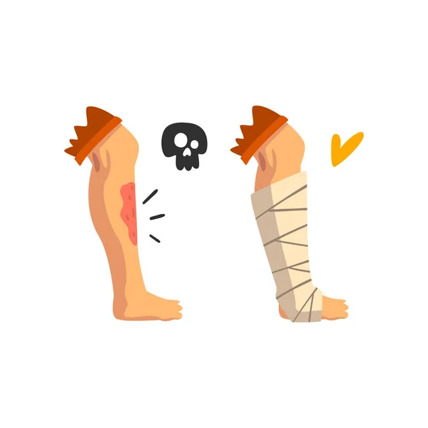 Pierna herida, lesión física, pierna vendada, primeros auxilios y vector de tratamiento Ilustración sobre fondo blanco — Archivo Imágenes Vectoriales