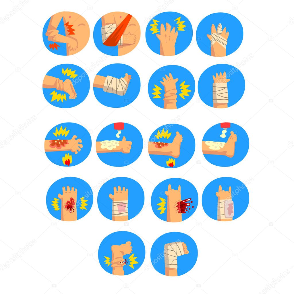 Damaged body parts set, sprains, fractures, burns of the arms and legs, first aid and treatment vector Illustration on a white background