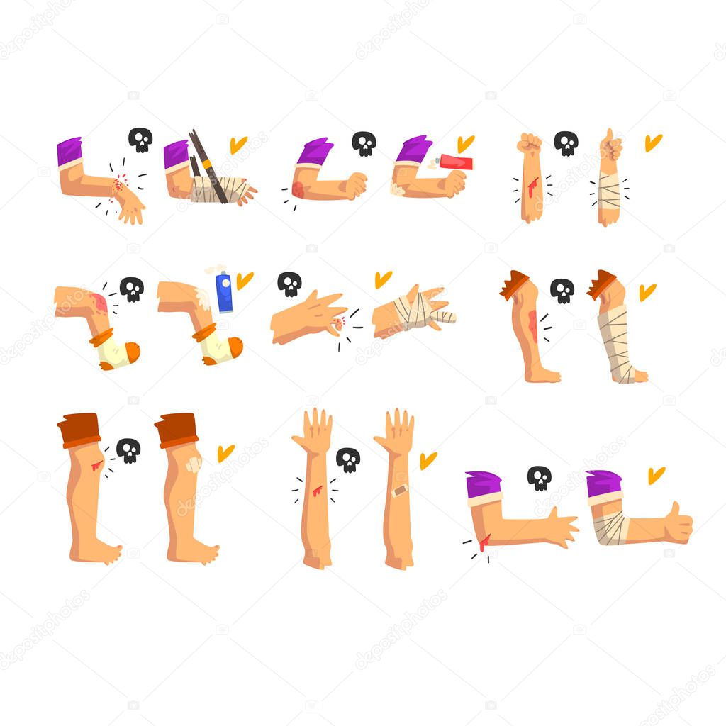 Damaged body parts set, injuries and fractures of the arms and legs, first aid and treatment vector Illustration on a white background