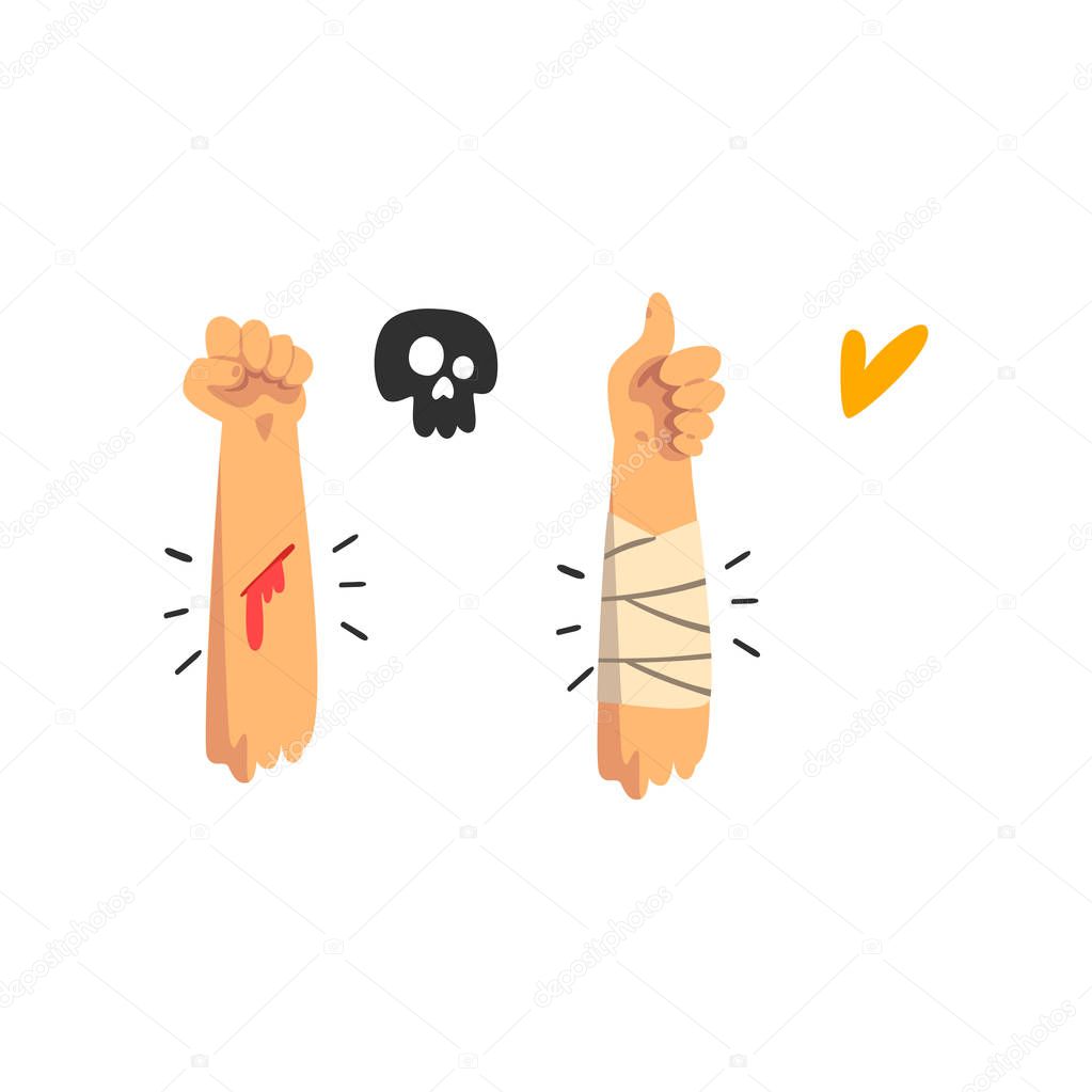 Bleeding wound on the hand, physical injury, bandaged hand, first aid and treatment vector Illustration on a white background
