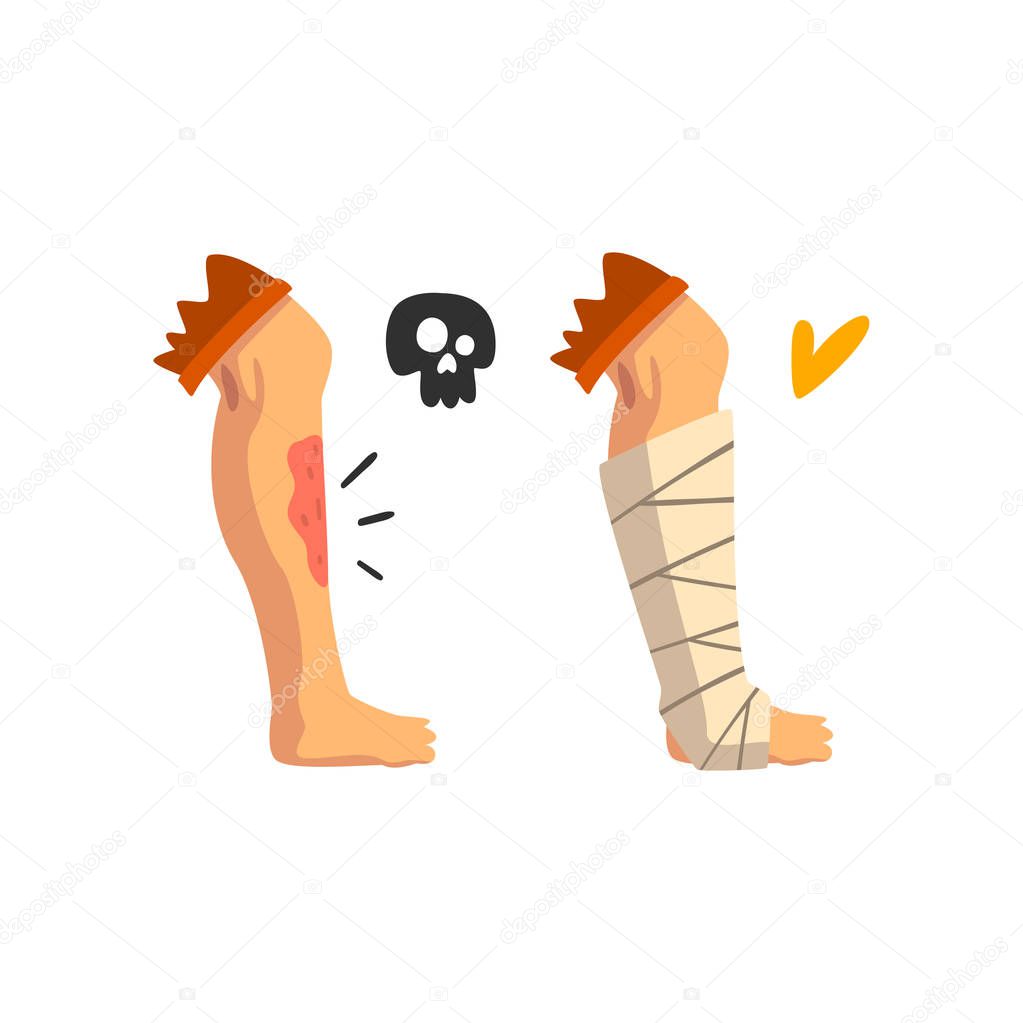 Wounded leg, physical injury, bandaged leg, first aid and treatment vector Illustration on a white background