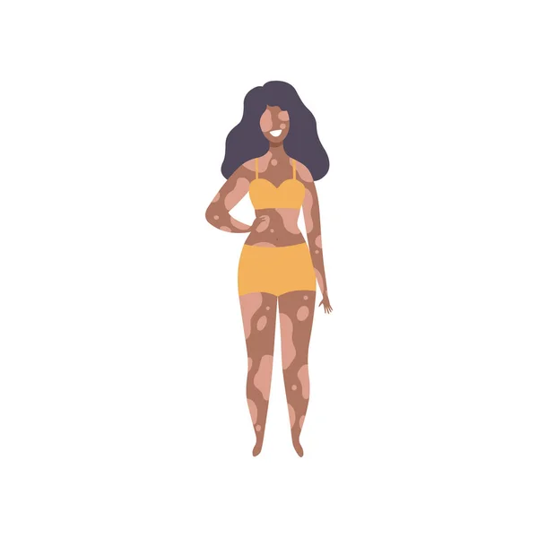 Heureuse belle femme afro-américaine avec vitiligo, corps positif, acceptation de soi et beauté concept de diversité Illustration vectorielle — Image vectorielle